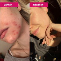 CLARIFYING MASK | Verfeinertes Hautbild dank 2% BHA