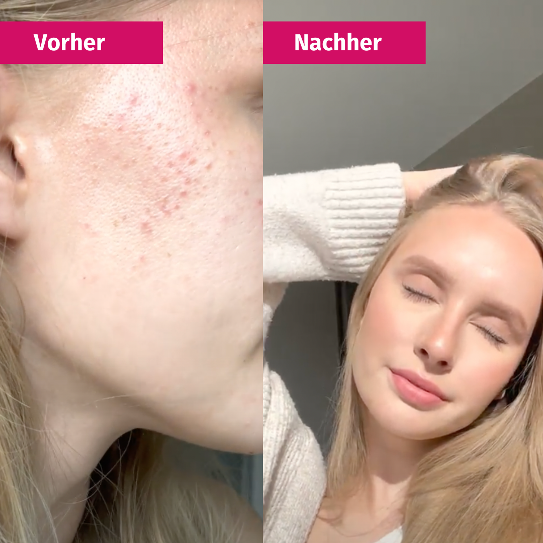 CLARIFYING MASK | Verfeinertes Hautbild dank 2% BHA
